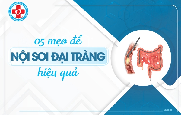 5 meo de noi soi dai trang hieu qua